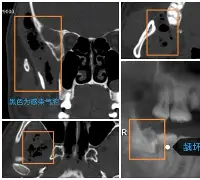 哎i7她vytvghdtyctd